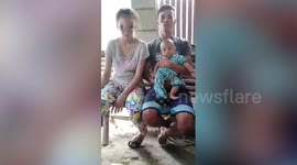 Beautiful Filipina teenager's face ravaged after squeezing a spot on her nose