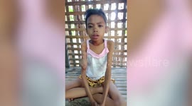 Filipina girl, 12, has mystery illness causing tumours on her arm and weight loss