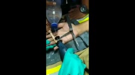 The Indonesian East Jakarta Fire Brigade Team Opens the Agate Ring of a Father who is Narrow in His Finger