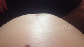 Kicking baby seen moving inside his mother's belly