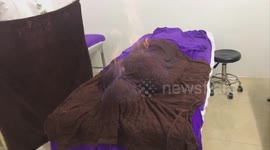 Burning fat has new meaning as woman has body lit on fire to lose weight