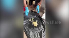 Shocked medics find 59ft long tapeworm in Thai man’s bottom