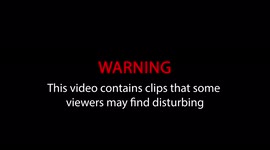 Mum's pregnancy caused rare condition that made heart stop THREE times