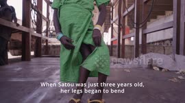 Six-year-old born with bent legs walks for the first time after life-changing surgery