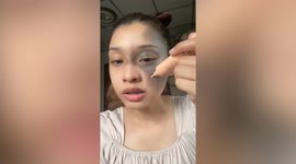 Woman born with large birthmark on face becomes TikTok star with makeup tutorials