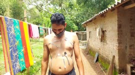 Indian man claims his skin has become magnetic after taking COVID-19 vaccine