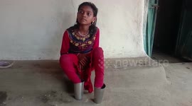 Administration forces specially-abled girl to use glass as feet in central India