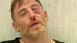 Far-right demonstrators attack journalists and LGBTQ activists ahead of Pride march in Tbilisi