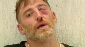 Cameraman dies days after far-right attack before Pride march in Tbilisi, Georgia