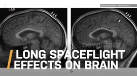 Could This Technique One Day Cure Blindness?