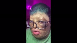 Man was given 1% chance to live after covering his body in FLAMMABLE LIQUID and causing an accidental explosion that killed his mother – now teaches 230,000 TikTok followers to love themselves