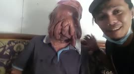 Indonesian man, 46, unrecognisable after mystery disease makes his face melt