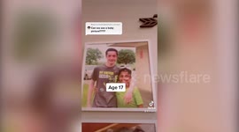 Teen born with vitiligo shares his story after being accused of 