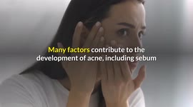 Worst Foods For Acne :- Avoid These Foods If You Have Acne [Foods That Worsen Your Acne]