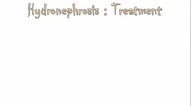 Hydronephrosis Treatment - Everything You Need To know.