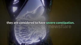 Foods That Cause Constipation |Worst Foods For Constipation |Constipation causing foods