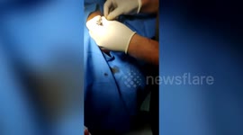 Man realizes bullet injury after 7 hours of being shot in northern India