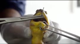 Softshell turtle rescued from nostril hook