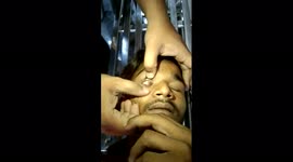 18 Year Old Boy Crying Stones instead of Tears in India