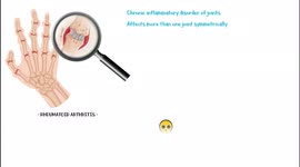 Symptoms Of Rheumatoid Arthritis [Early & Late] What Is Rheumatoid Arthritis & How It Affects you