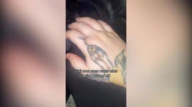 UK mum's tattoo erupts in painful warts due to rare reaction to pregnancy