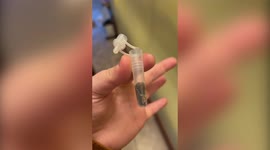 Studio manager gets the shock of their life after finding a SLUG in their lateral flow test