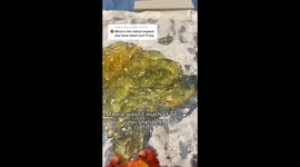 ‘I’ve taken out 45-year-old implants and removed CONCRETE from botched b*m jobs': Plastic surgeon reveals the weirdest things he's seen – and his most amazing transformations