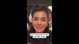 'My fillers DEFORMED my face,' reveals woman, 24, with TikTok users saying she looks '10 years younger' after getting them removed