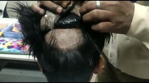 Gold smuggler hides contraband in wig but is caught by Indian custom officials