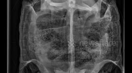 Check out this fascinating scan of a tortoise