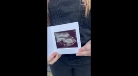 'UK couple opts for a 'simple but exciting' approach for their first child's gender reveal '