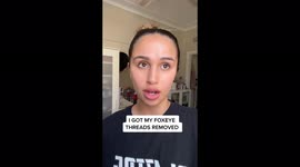 Model, 21, who looked like 'alien with horns' from botched thread lift has them REMOVED – but now 'looks like egg' PART ONE