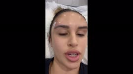 Model, 21, who looked like 'alien with horns' from botched thread lift has them REMOVED – but now 'looks like egg' PART TWO