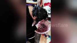 Woman's scalp turns purple after trying to use blackberries to dye hair in China