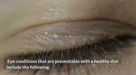 Best Foods To Improve Eyesight & Prevent Eye Disease :- Healthiest Foods For Your Eyes |Eye Foods