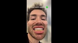 'Have fun doing this every 10 years': Man leaves TikTok users shocked getting BUDGET teeth shaving in Turkey – having already splashed out £13,000 on mouth.