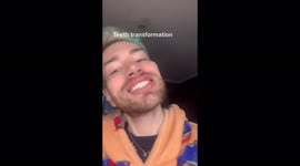 'Have fun doing this every 10 years': Man leaves TikTok users shocked getting BUDGET teeth shaving in Turkey – having already splashed out £13,000 on mouth. Part 3