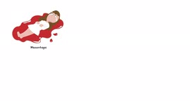 What Causes Heavy Menstrual Bleeding (Menorrhagia) |Causes Of Heavy Menstrual Bleeding