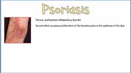 Psoriasis :- Overview [What is it, Types, Signs & Symptoms, Treatment]