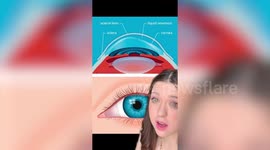 Blind woman who regained her vision said her husband was 