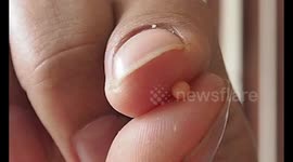 Thai man finds rare EXPENSIVE pearl while having romantic dinner