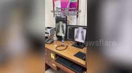 Brit tourist hospitalised in Thailand with internal bleeding after horror backflip on inflatable assault course