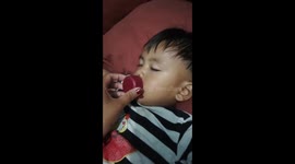 Huge lips of a child after putting bottle cap. Prank!