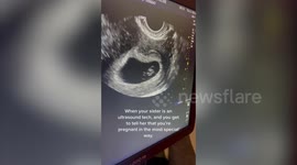 Mum-to-be announce pregnancy to sonographer sister by turning up for ultrasound scan
