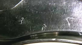 Parasites discovered in man's eye