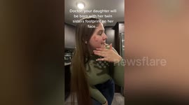 I was born with a unique birthmark on my face - my twin's footprint when we were together in the womb