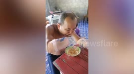 Clever villager with amputated hands uses homemade 'prostheses' to eat rice