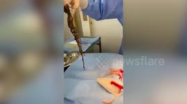 Woman forks out £2,600 surgery for her dog to remove a huge bundle of 44 HAIRBANDS