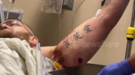 Pictures of the wounds