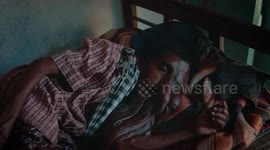 'Children are scared of me' says Indian man with face that looks like it's hanging off